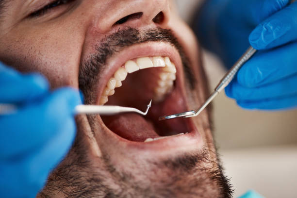 Best Dental Inlays and Onlays  in East Bernard, TX